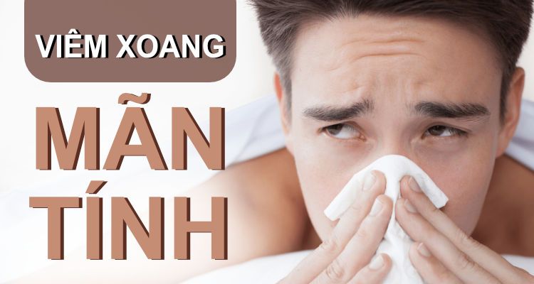 Viêm xoang là gì ? Các dạng viêm xoang thường gặp.